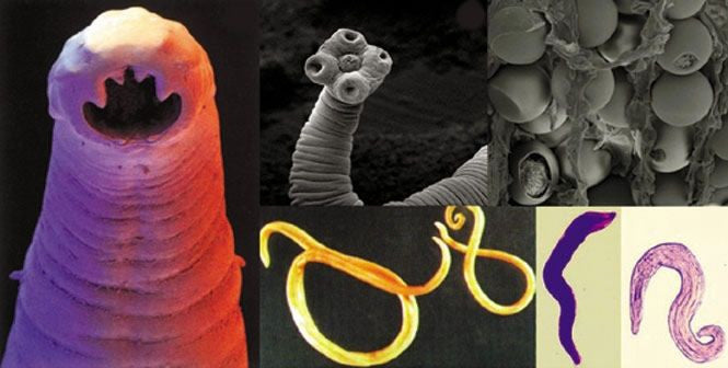 These BUGgers are a big issue - Candida, Yeast, and Parasites!